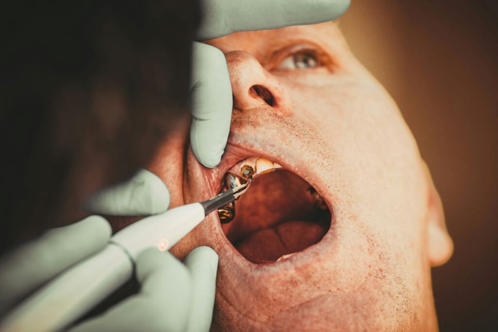 oral cancer