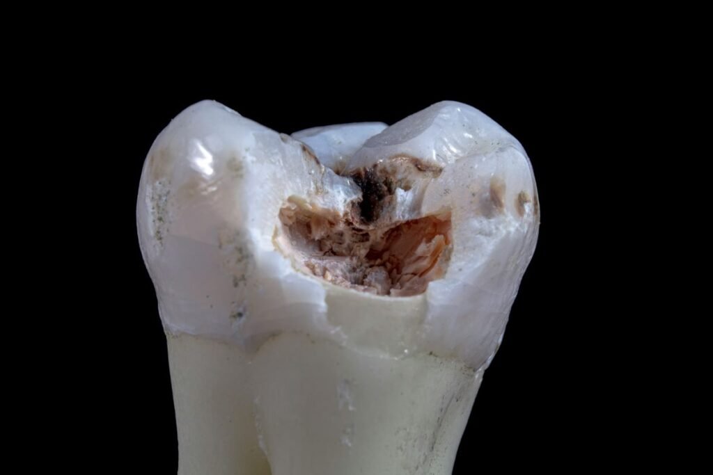 toothache